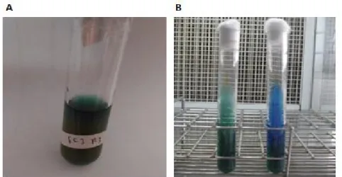 Gambar 6. Gambar A menunjukkan hasil uji sitrat negatif pada sampel urin  pasien ISK, Gambar B menunjukkan hasil uji sitrat jika bewarna  biru (+) dan tidak berubah tetap hijau (-)
