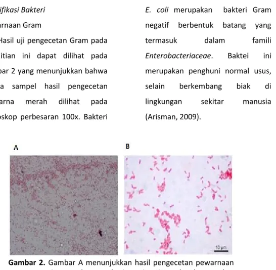 Gambar  2.  Gambar  A  menunjukkan  hasil  pengecetan  pewarnaan  Gram pada sampel urin pasien ISK, sedangkan gambar  B  menunjukkan  pewarnaan  Gram  negatif  berdasar  literatur