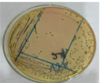 Gambar 1. Medium VJA (Vogel Johnson Agar) yang menunjukkan hasil positif Staphylococcus aureus.
