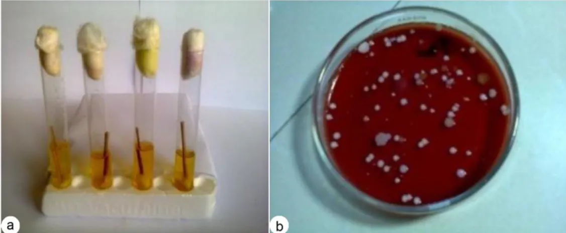 Gambar 1. Isolat bakteri yang diisolasi dari ruang UGD. a. isolat berasal dari  alat kesehatan, dan b