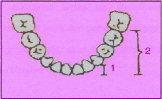 Gambar 4. Panjang anterior (1) dan                   posterior (2) lengkung gigi 8 