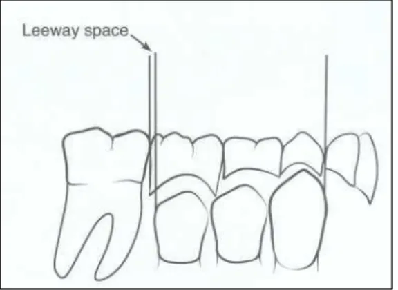 Gambar 9. Leeway space. 2 