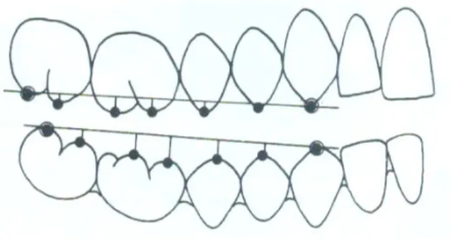 Gambar 2.4 Pengukuran kedalaman Curve of Spee.  