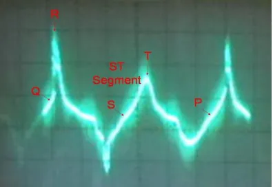 Gambar 2. Gelombang elektrokardiograf aktivi-tas jan tung ikan nila 
