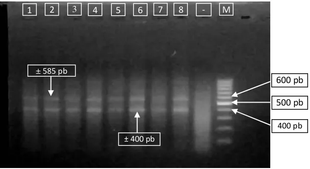 Gambar 2. Hasil amplifikasi gen MHC II dari yuwana gurami sowang menggunakan pasangan primer ke-dua