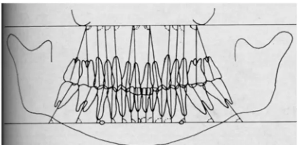 Gambar 5. Sudut-sudut angulasi yang diukur 