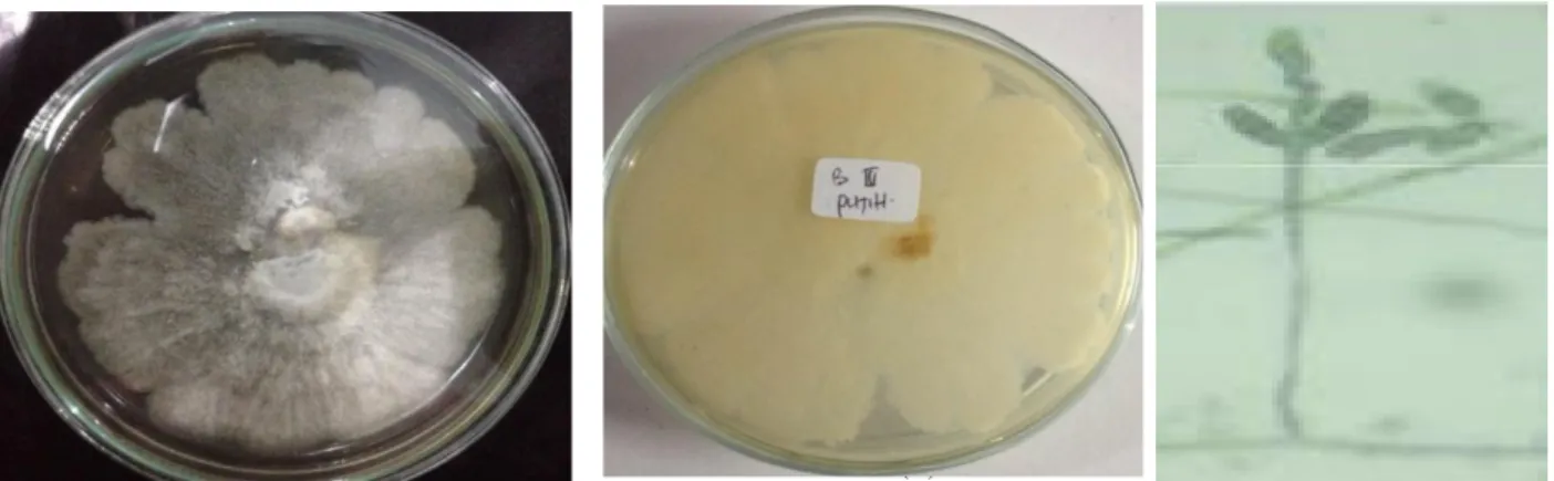 Gambar 2.  (a) isolat kapang 2 tampak  atas (b) isolat kapang  2 tampak bawah (c) pengamatan  mikroskopis isolat 2 pada perbesaran 400 × 