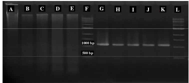 Gambar 5 Hasil elektroforasi total genom dan produk PCR