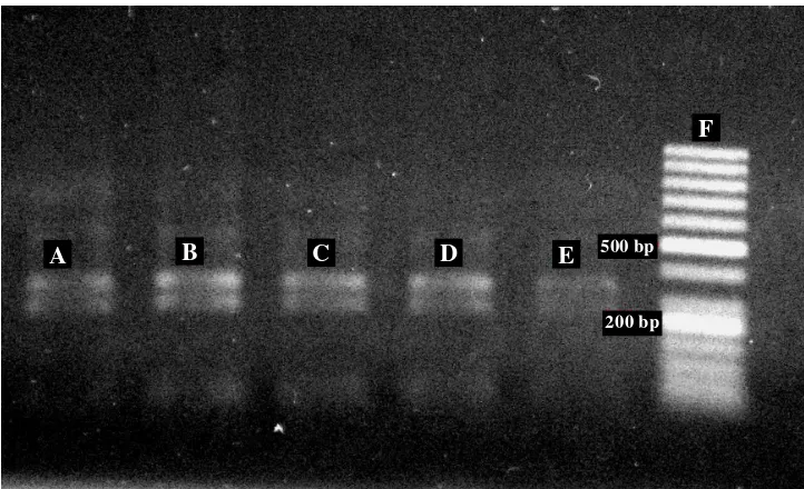 Gambar 6 Elektroforasi hasil pemotongan DNA dengan enzim Taq1