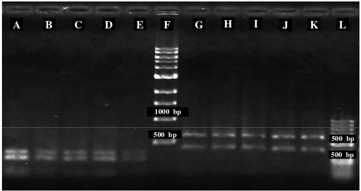 Gambar 7 Elektroforasi hasil pemotongan DNA dengan enzim MBo1 dan Alu1.