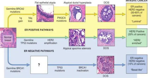 Gambar 2.6 Jalur utama perkembangan kanker payudara (Lester, 2015).