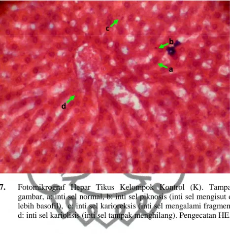 Gambar 7.  Fotomikrograf  Hepar  Tikus  Kelompok  Kontrol  (K).  Tampak  dalam  gambar, a: inti sel normal, b: inti sel piknosis (inti sel mengisut dan tercat  lebih basofil),  c: inti sel karioreksis (inti sel mengalami fragmentasi), dan  d: inti sel kari