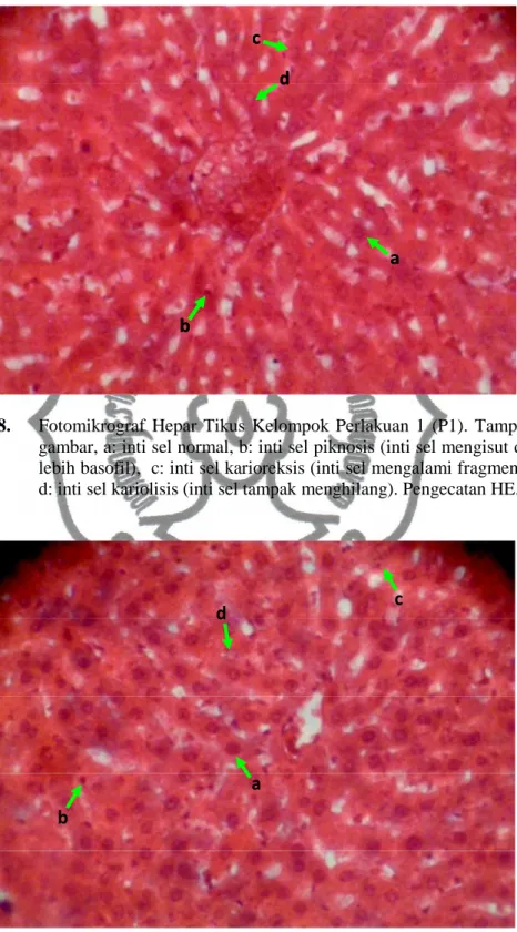 Gambar 8.  Fotomikrograf  Hepar  Tikus  Kelompok  Perlakuan  1  (P1).  Tampak  dalam  gambar, a: inti sel normal, b: inti sel piknosis (inti sel mengisut dan tercat  lebih basofil),  c: inti sel karioreksis (inti sel mengalami fragmentasi), dan  d: inti se