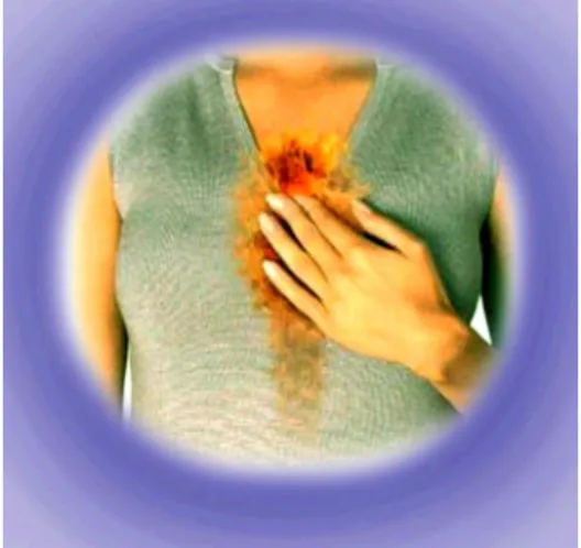 Gambar 2. Heart burn