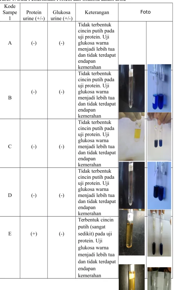 Tabel 1. Data Pemeriksaan Protein dan Glukosa dalam urine Kode Sampe l Protein urine (+/-) Glukosa urine (+/-) Keterangan Foto A (-) (-) Tidak terbentuk  cincin putih pada uji protein