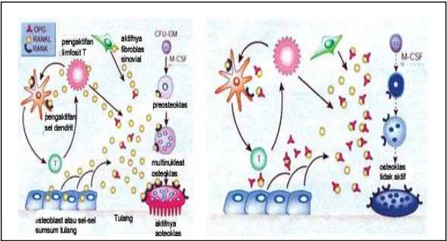 Gambar 6. Mekanisme aktifitas ekspresi RANKL oleh berbagai tipe sel dalam menginduksi osteoklastogenesis yang diikuti dengan mengikat RANK pada prekusor osteoklas (kiri)