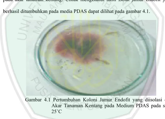 Gambar 4.1 Pertumbuhan Koloni Jamur Endofit yang diisolasi dari  Akar Tanaman Kentang pada Medium PDAS pada suhu  25˚C 