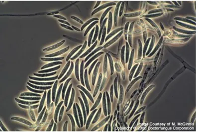 Gambar 7. Jamur Fusarium sp. secara mikroskopis. 