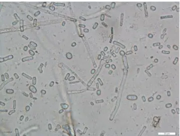 Gambar 2. Spora Geotrichum candidum secara mikroskopis. 