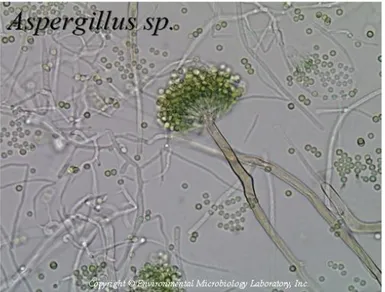 Gambar 5. Jamur Aspergillus secara mikroskopis. 
