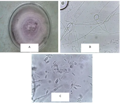 Gambar 8.  Gambar makroskopis dan mikroskopis isolat NS243A. Inkubasi 14  hari (a), hifa (400 x) (b), dan spora (1.000x) (c)