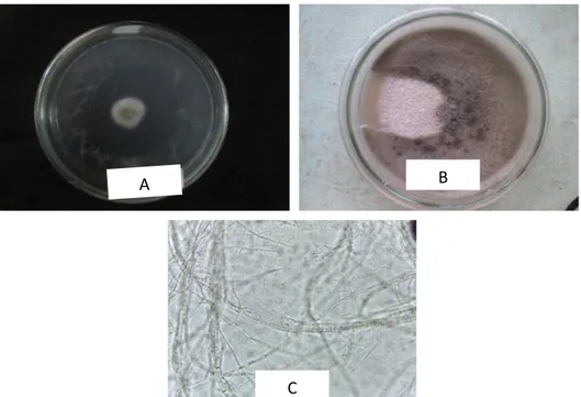 Gambar 9.  Gambar makroskopis dan mikroskopis isolat GS42A. Inkubasi 7 hari  (a), inkubasi 14 hari (b), dan hifa bersekat (400 x) (c)