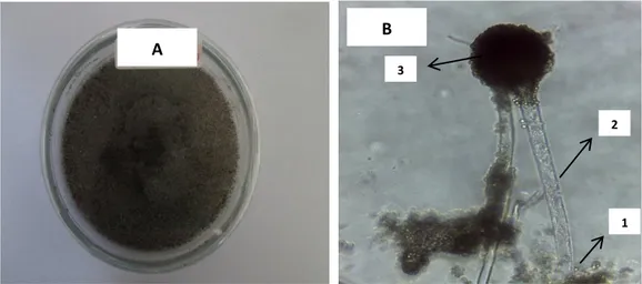 Gambar 2.  Gambar makroskopis dan mikroskopis Aspergillus sp..  Koloni  berwarna hitam pekat (a) dan morfologi Aspergillus sp