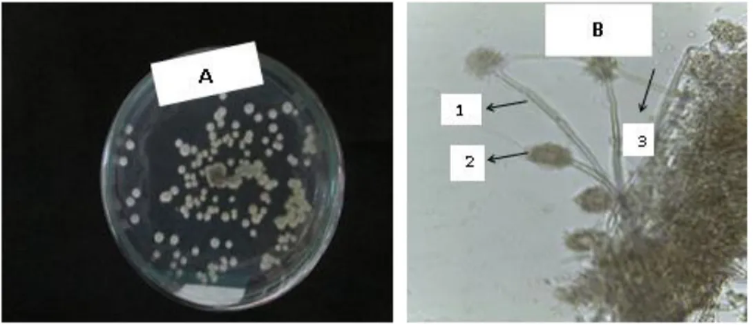 Gambar 3.  Gambar makroskopis dan mikroskopisisolat GS52A.  Koloni  berwarna hujau pekat (a) dan morfologi Aspergillus sp