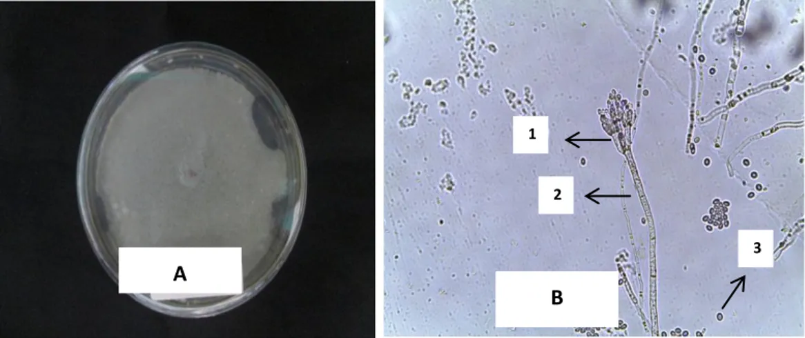 Gambar 5.  Gambar makroskopis dan mikroskopis Penicillium sp. Koloni 