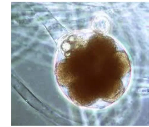 Gambar  6.  Gambar  jamur  yang  dikultur  dan    diamati  dengan  mikroskop  perbesaran 10x10 2 mm 