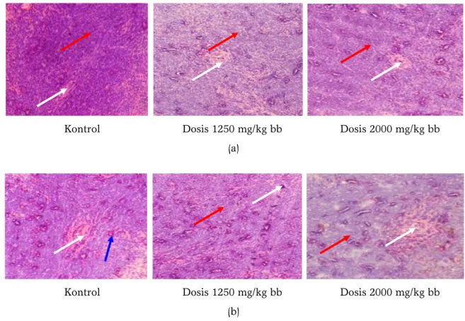 Gambar 7.  Histologi organ limpa mencit jantan (a) dan betina (b) setelah pemberian akut-oral 