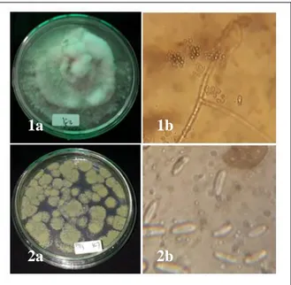 Gambar 2. Bentuk makroskopis dan mikroskopis jamur entomopatogen 1a). Beauveria bassiana pada media  PDA  1b)