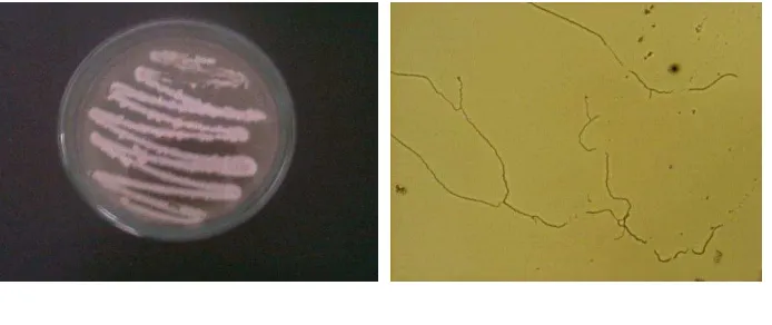 Gambar  3.  A. Isolat actinomycetes ANL-4, B. Isolat actinomycetes ANL-4  