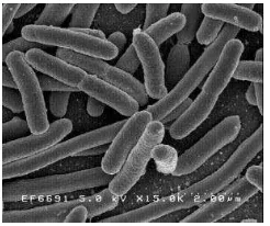 Gambar 2. Escherichia coli (Yalun, 2008) 