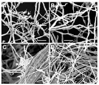 Gambar 5 : Cendawan Phytophthora parasitica Dastur 