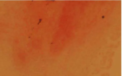 Gambar 7. Bentuk Staphylococcus menurut Anonim (2009) 