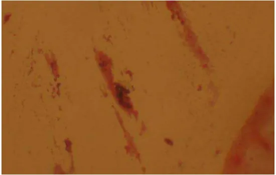 Gambar 9. Bentuk Bacillus menurut Anonim (2009) 