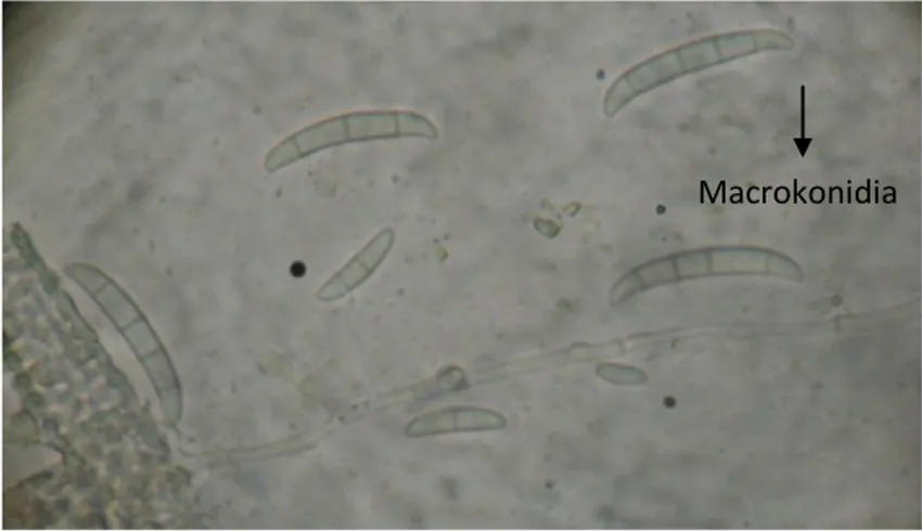 Gambar 4. Makrokonidia Fusarium sp. pada perbesaran 4000x Macrokonidia 