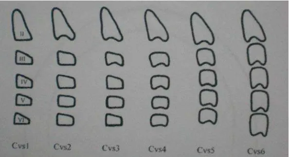 Gambar 9. Vertebra servikal Cvs1 – Cvs6. 12