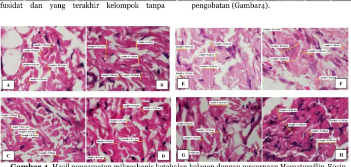 Gambar 4. Hasil pengamatan mikroskopis ketebalan kolagen dengan pewarnaan Hematoxyllin-Eosin 