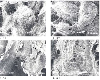 Gambar 2. Foto scanning electron microscopy perbesaran 75x pada testa benih pepaya dari berbagai metoda penanganan benih, setelah dicuci sarcotesta-nya tanpa perlakuan pra-perkecambahan  