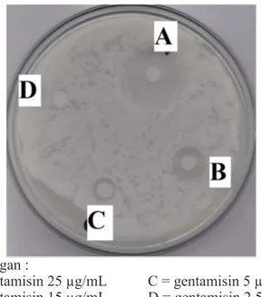 Gambar 2. Hasil MIC gentamisin sulfat terhadap bakteri Escherichia coli