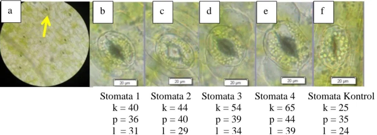 Gambar  1.  Kimera  stomata  daun  planlet  Dendrobium  sylvanum  var.  flava  MV2  pada  perlakuan  K5T2M2.2  (konsentrasi  kolkisin  0.1%,  durasi  perendaman  kolkisin  24  jam,  media 