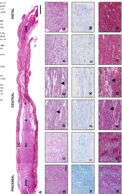 Fig. 3 Morphologic analysis ofhistochemical evaluation of theCC graft with the LFB method,shows a progressive decrease ofthe myelin histochemicalreaction along the graft (the collagen conduit (CC) graft.Histochemical composition ofthe entire collagen condu