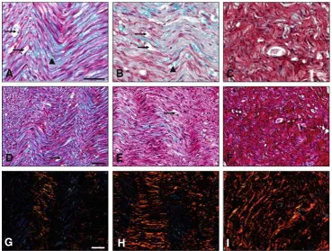 Fig. 4 Light (CC graft stained with the new MCOLL histochemical method.Proximal sciatic nerve (a–f) and polarized light (g–i) microscopy images of thea, d, g)