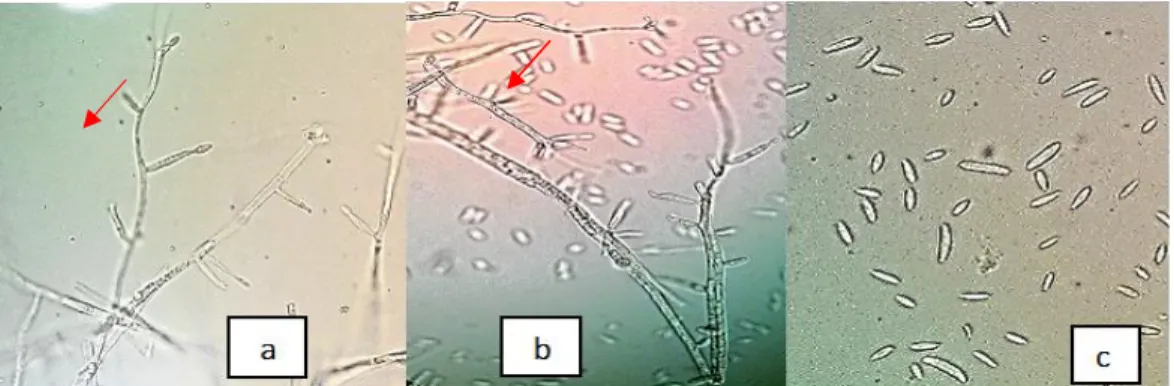 Gambar 2 Hasil visualisasi DNA Lecanicillium isolat Bogor menggunakan primer ITS1 dan  ITS4  
