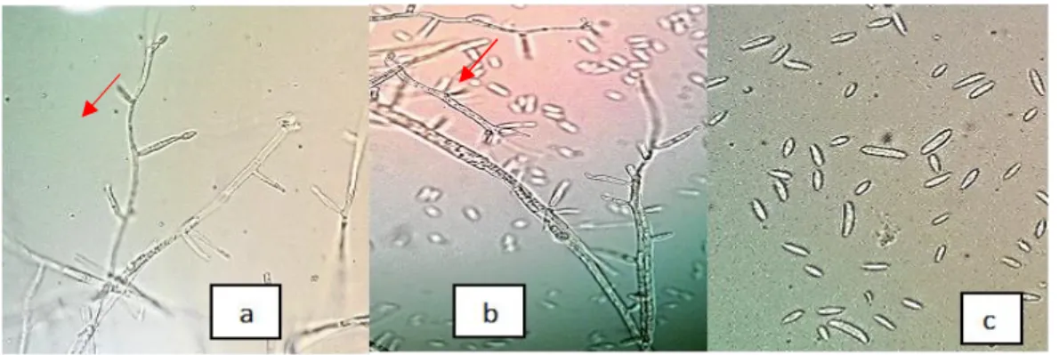 Gambar  1  Lecanicillium  isolat  Bogor  a.  Fialid  yang  sedang  berkembang,  b.  Fialid  dengan  konidium, c