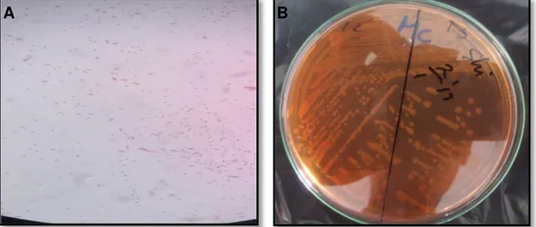 Gambar 1. Hasil identifikasi umum dan identifikasi khusus bakteri uji.   A. Shigella flexneri bakteri Gram negatif dengan bentuk kokobasil