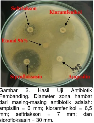 Gambar  2.  Hasil  Uji  Antibiotik  Pembanding.  Diameter  zona  hambat  dari  masing-masing  antibiotik  adalah:  ampisilin  =  6  mm;  kloramfenikol  =  6,5  mm;  seftriakson  =  7  mm;  dan  siprofloksasin = 30 mm