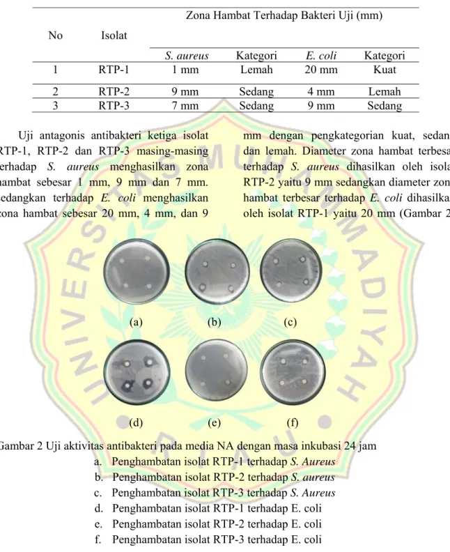 Tabel 2 Hasil uji aktivitas antibakteri terhadap S. aureus dan E. Coli
